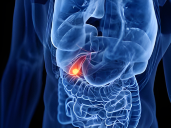 gallbladder disorders ​