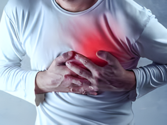 heart attack (myocardial infarction)