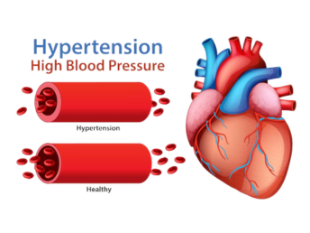 hypertension
