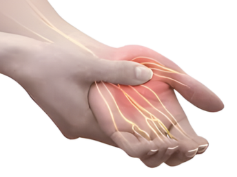 peripheral nerve injuries ​