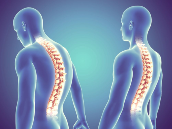 spinal disorders ​