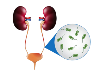 urinary track disorder