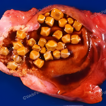 untitled (340 x 340 px) (23)