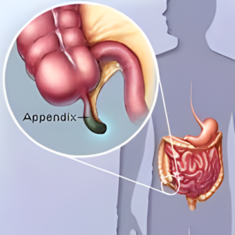 untitled (340 x 340 px) (24)